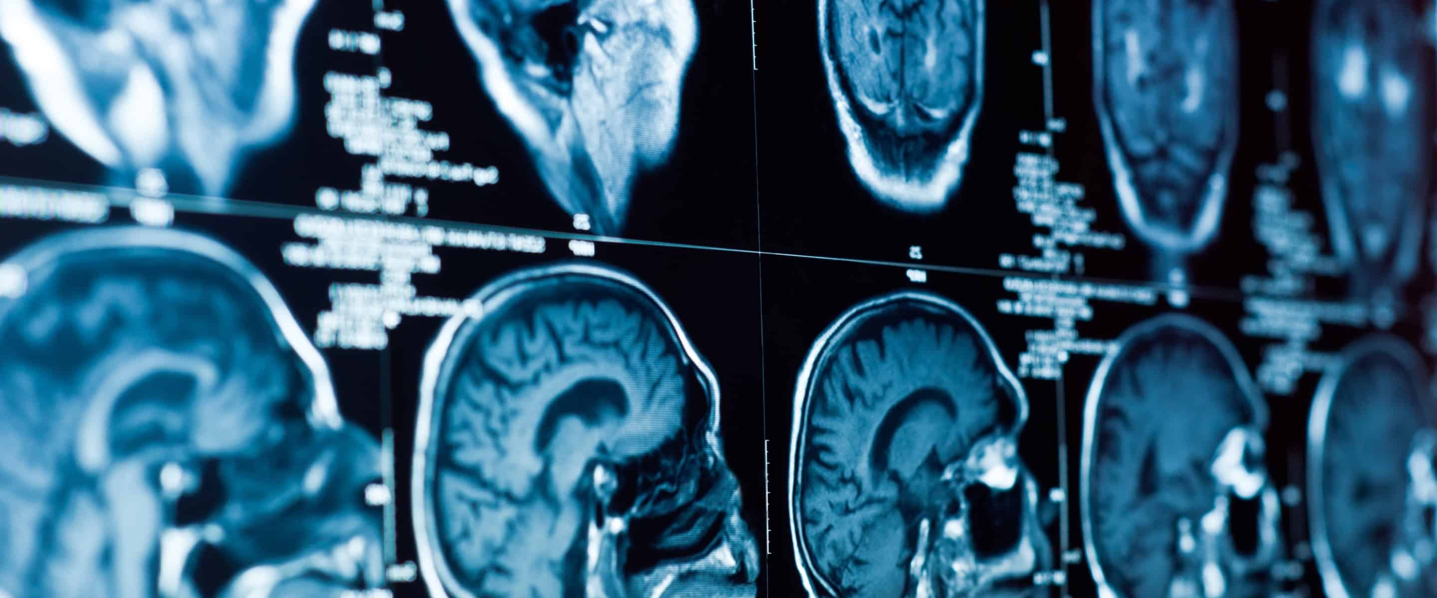 CAT Scan Zoomed In