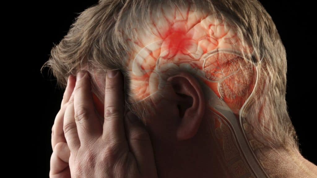 Mobile brain scanners for stroke