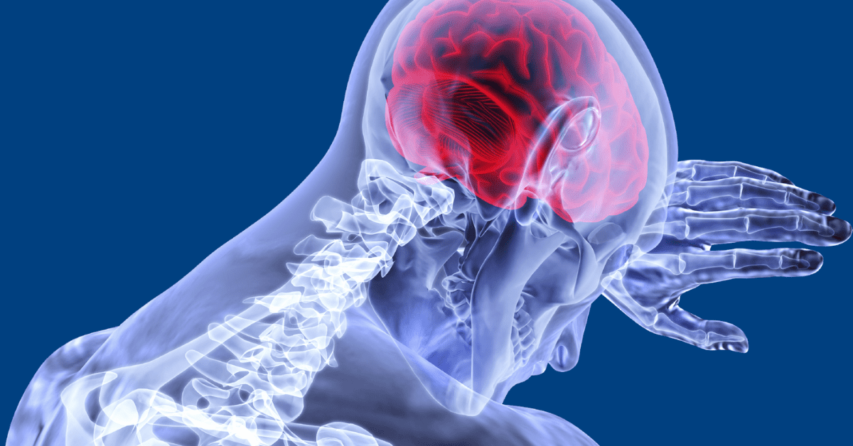 Israeli Startup Uses AI and Deep Learning to Create Life-Saving Stroke Detection Platform | blog article by Catalina Imaging