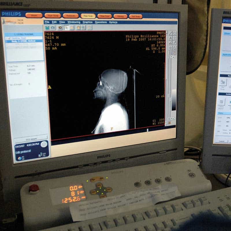 mobile CT scanner 16 slide system